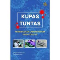 Kupas tuntas pemeriksaan laboratorium pada Covid-19